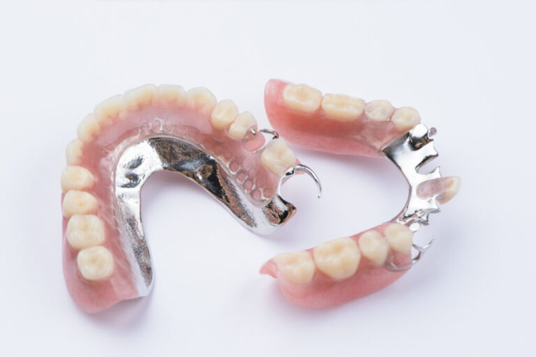 Chrome Cobalt Dentures Ardent Smile Chrome Cobalt Dentures Ardent Smile
