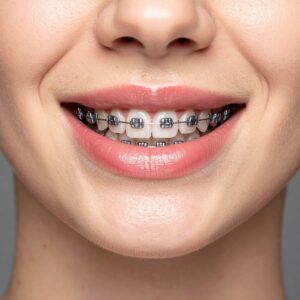Orthodontic Care in Clapton – Straighten Teeth with Modern Options